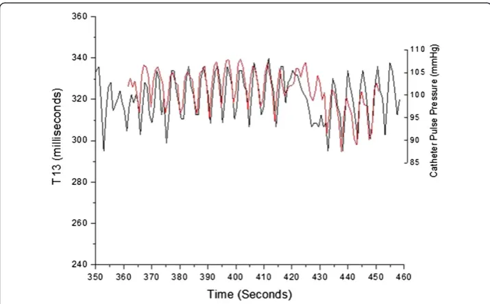 Figure 7 Overlap of central pulse pressure (red) obtained from catheter signal and T13 delay timeobtained from PDA analysis of non-invasively obtained arterial signal (black) for patient 38.