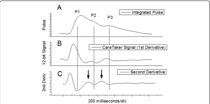 Figure 2 Different pressure pulse spectra of a 21-old male athlete. (A) Arterial pressure pulse obtainedfrom digital integration of signal displayed in (B): derivative signal of arterial pressure pulse obtained withCareTaker physiological monitor (C); seco