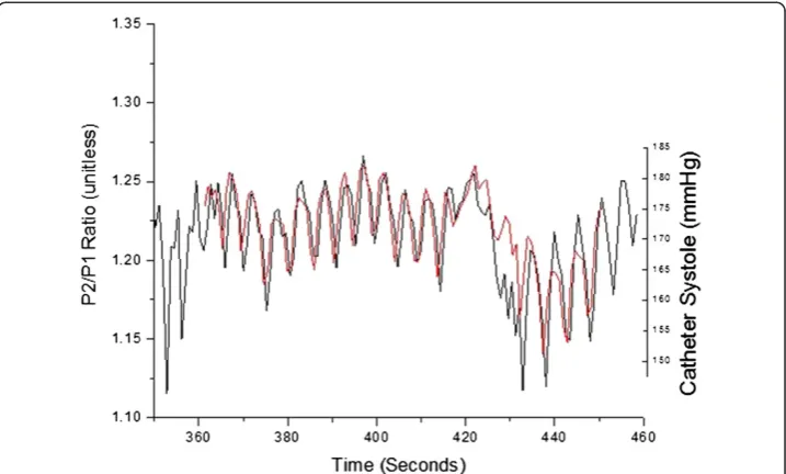 Figure 5 Overlap of the inter-beat interval series obtained from central line catheter (red) and dataobtained with the CareTaker physiological monitor (black) for patient 38.