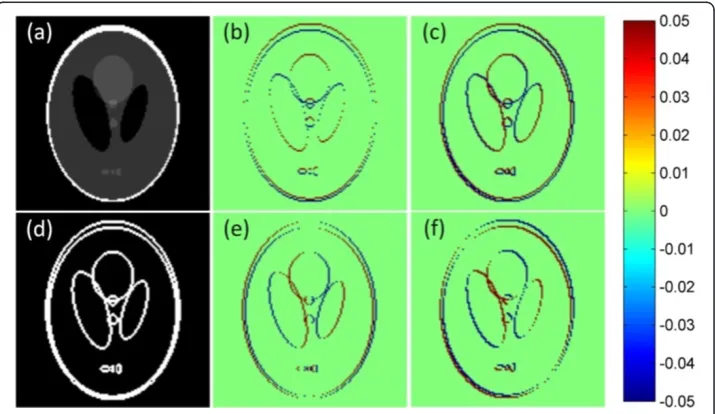 Figure 3 The Shepp-Logan phantom and edges. (a)gray scale window of [0,1], (b) its horizontal edges The original Shepp-Logan phantom with display Eh, (c) rotated horizontal edges Ehr, (d) gradient imagewith display gray scale window of [0,0.01], and (e) ve