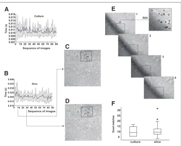 Figure 7 Video-rate frame by frame detection using SURF. (A), (B) Mean time (black line) and 95% CI(gray shadow) for the detection of keypoints in culture and slice images sequences, respectively