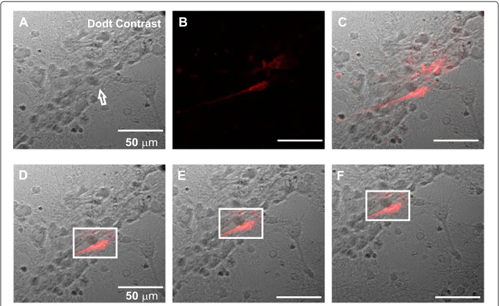 Figure 3 Images of brain slices in different conditions. (A) Slice image used as a template for theselection of a ROI