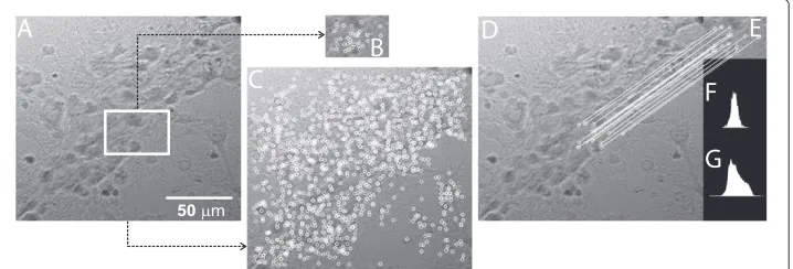 Figure 5 SURF algorithm. (A) Image with a ROI selected (white square) acquired by user