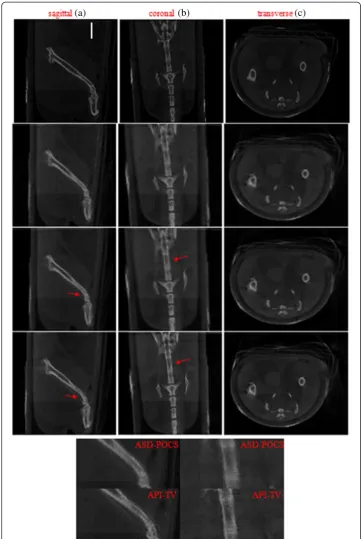 Figure 6 Images of the laboratory mouse within sagittal (a), coronal (b), and transverse (c) slicesreconstructed from the 120-view data by use of the (row 2) ART, (row 3) ASD-POCS, and (row 4)API-TV algorithms, respectively