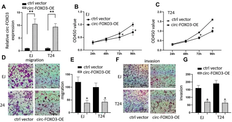 Figure 1 The expression of circ-FOXO3 was down-regulated in bladder cancer tissues and cell lines