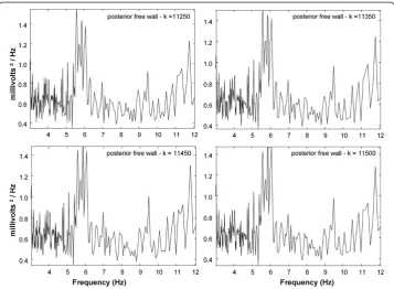 Figure 4 NSE spectra using the real-time software algorithm for small shifts of 50-100 millisecondsin analysis window location