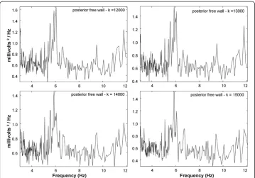 Figure 5 NSE spectra using the real-time software algorithm for larger change in analysis windowlocation of 1000 milliseconds