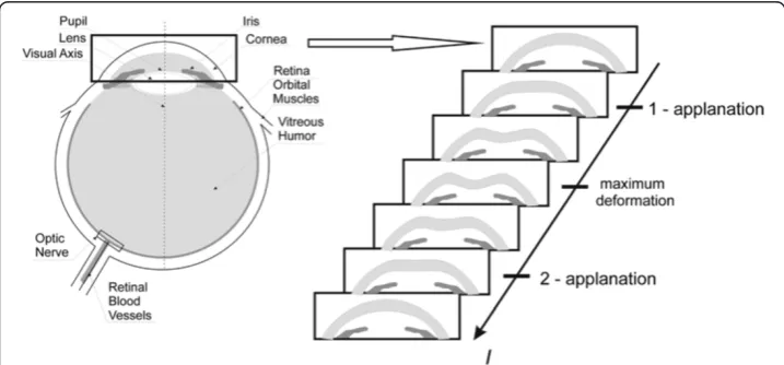 Figure 1 Schematic diagram showing methodology of the measurement method and cornealresponse