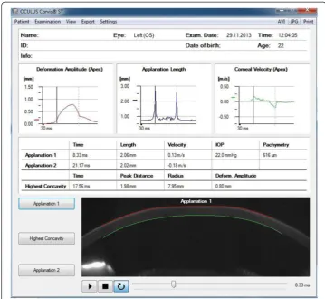 Figure 2 Examples of results obtained from the Corvis device. There are three graphs: deformationamplitude, applanation length, corneal velocity and two examples of applanation