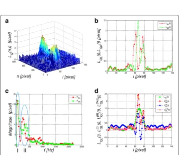 Figure 7 Waveform LT(n,i), LTO(n,i) and LTR(n,i). Separation of the waveforms (LTO(n,i) and LTR(n,i)) enabledseparation of the entire eyeball reaction from the cornea response to an air-puff stimulus