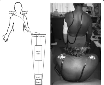Figure 2 Structure of the new biomechatronics wrist prosthesis. Noted that the ultrasonic sensorswere attached on the shoulder to rotate the servo motor placed inside the prosthesis hand.