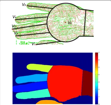 Figure 6 Contours of melanin and haemoglobin images presented as components R-red andand the result of automatic segmentation into characteristic areas, described in the paper, are shown onG-green respectively