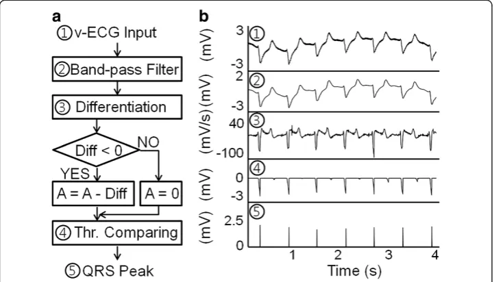 Figure 2 v-ECG-based QRS peak detection algorithm implemented for LibraHeart I (a) and signalpatterns before, during, and after peak detection processing (b)