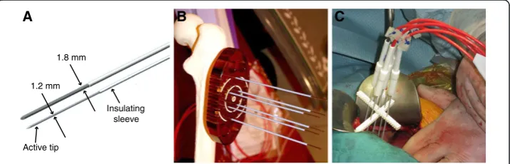 Table 3 Different types of electrodes developed for electrochemotherapy of visceral anddeep-seated tumors