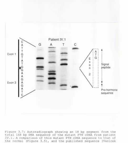 Figure 3.7: Autoradiograph showing an 18 bp segment from the total 168 bp DNA sequence of the mutant PTH cDNA from patient 