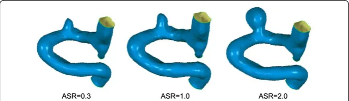 Figure 4 The illustration of scaled models. The scaling procedure is performed by changing the ASR ofthe aneurysm, three images are presented with ASR of 0.3, 1.0, and 2.0, respecitively.