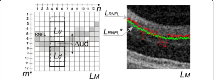 Figure 6 The results of the dynamic adjustment of the contour position.between the areas On the left side, the idea ofthe dynamic contour position adjustment has been shown