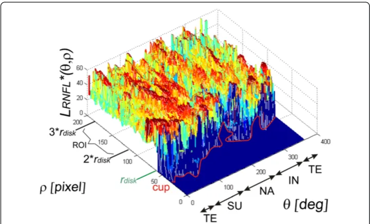 Figure 7 The results of the region of interest (ROI) separation in the polar coordinate presented inCartesian coordinate system