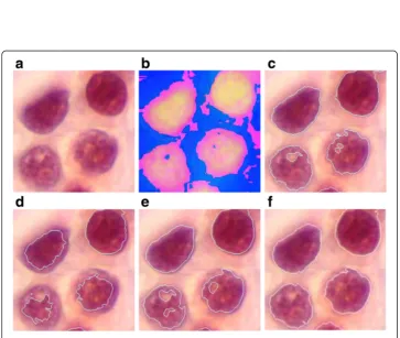 Figure 7 Edge detection performance comparisons for cells image. (a) original image, (b) edgesobtained by the proposed technique, using the first order statistical features (c) edges obtained by theproposed technique, using the second order statistical fea