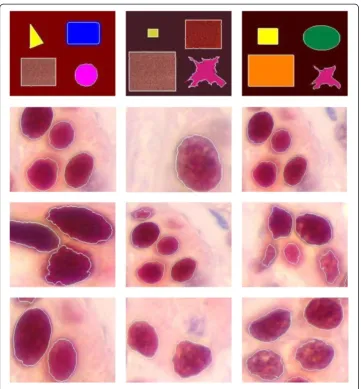 Figure 10 Color edges detection.