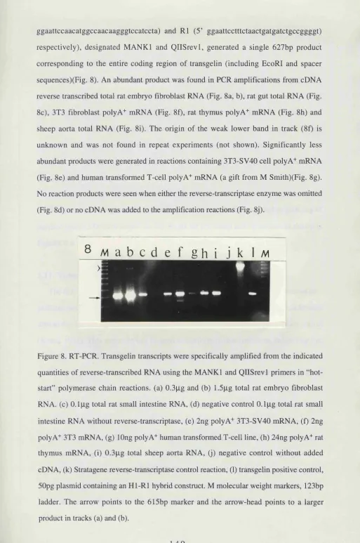 Figure 8. RT-PCR. Transgelin transcripts were specifically amplified from the indicated 