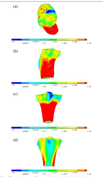 Figure 5 The simulation result of 3D proximal tibia for old people with 6° valgus deformity.(a) Top view