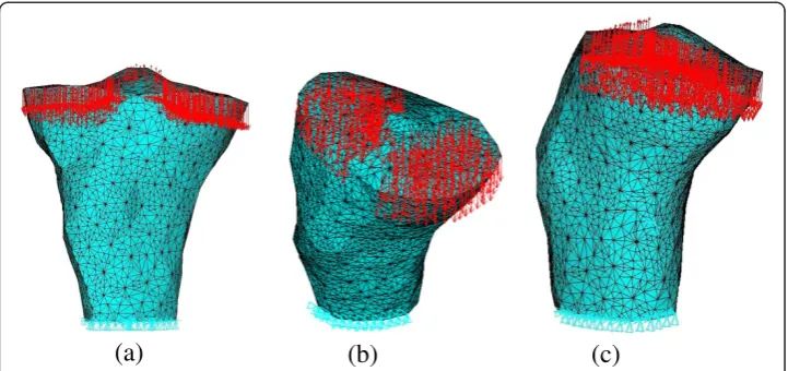Figure 2 The 3D finite element model of proximal tibia. (a) Front view. (b) Top view. (c) Right view.