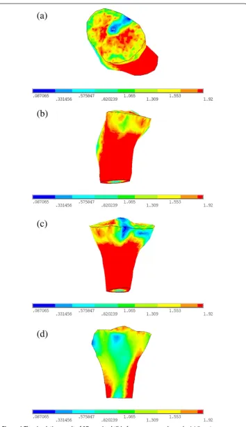 Figure 4 The simulation result of 3D proximal tibia for young normal people. (a) Top view.(b) Right view