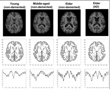 Figure 2 Typical example of brain MR image for each group. Typical examples of brain MR image foreach group