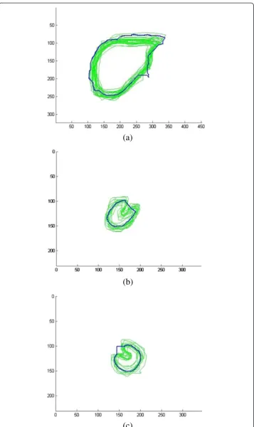 Figure 6 Shape template set and initial contour registration, (a) liver; (b) right kidney; (c) left kidney.