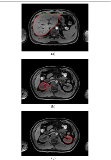 Figure 8 Segmentation results of proposed novel method, (a) liver (η=0.65); (b) right kidney(η=0.72); (c) left kidney (η=0.75).