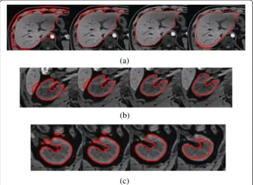 Figure 10 The segmentation of different η using the proposed method, from left to right in eachrow, (a)liver:η= 0.8, 0.7, 0.65, 0.6; (b) right kidney: η= 0.8, 0.75, 0.72, 0.7; (c) left kidney: η= 0.9, 0