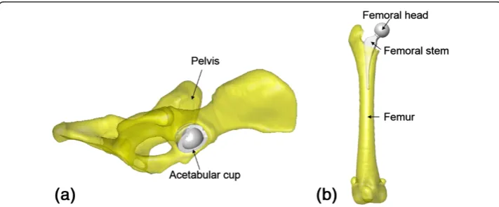 Figure 2 Computer simulation of THR surgery using computer models of the patient-specific bonesand THR models: (a) implantation of the acetabular component (grey) into the pelvic bone (yellow),and (b) implantation of the femoral component (grey) into the femur (yellow).