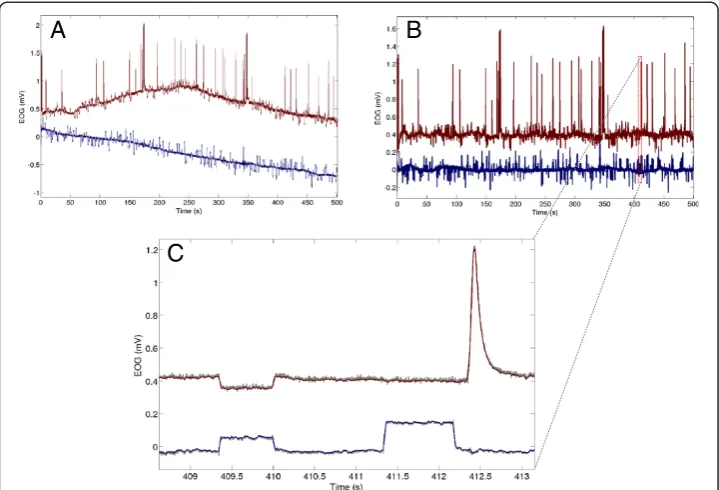 Figure 4 Denoising. A) Raw EOG signal (EOGv is red and EOGh is blue) and B) baseline drift removed EOGsignals