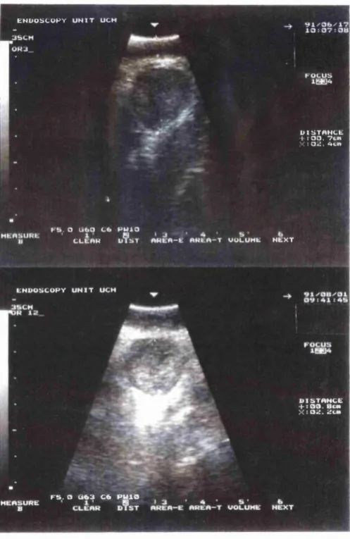 Figure 4.6 B Sequential endoluminal ultrasound images