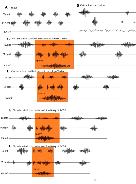 Figure 1 Electromyographic (EMG) recordings of the effects of BoT-A Botox on SCI-induced muscle spasticity