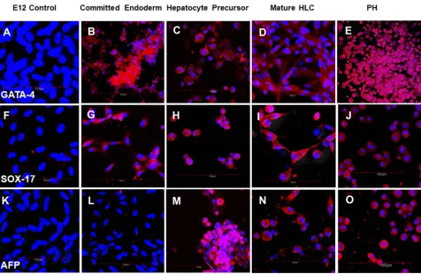 Figure 2 Phase contrast of differentiating MLPC E12 clone and primary hepatocytes. (in Activin A medium (Committed endoderm); (medium (Hepatocyte precursor); (and 7 days of differentiation in hepatocyte maturation medium (Mature HLC); and (A) E12 clone of MLPC-TERT cells; (B) MLPC E12 clone after 6 days of differentiationC) MLPC E12 clone differentiated for 6 days in Activin A medium and 14 days of differentiation in hepatocyte inductionD) MLPC E12 clone differentiated for 6 days in Activin A medium, followed by differentiation for 14 days in hepatocyte induction mediumE) primary human hepatocytes (PH).