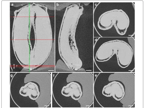 Fig. 8 Cross‑sections at different positions of a wheat grain sample at 240 °DAA. a A frontal slice of the grain; b A sagittal slice of the grain corresponds to the green line on a; e, f, g Cross‑sections at the bottom of the grain, which correspond to red