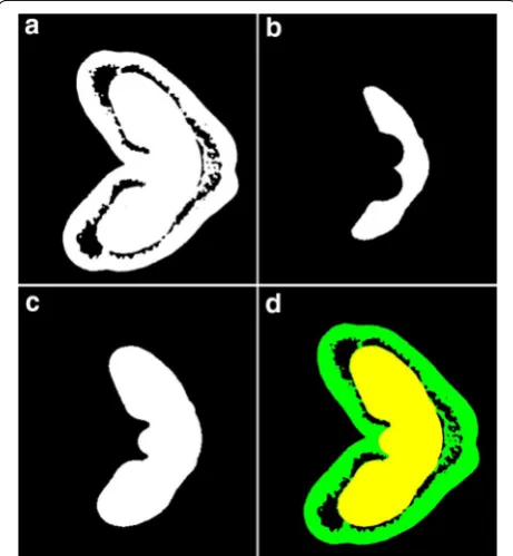 Fig. 3 Workflow of wheat outer and inner tissues segmentation on FiJi. a A μCT cross‑sectional slice in 8‑bit binary; b Result of erosion on a; c Result of dilation on b; d Superimposition of c over a