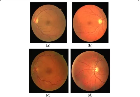 Figure 2 Retinal components [8].