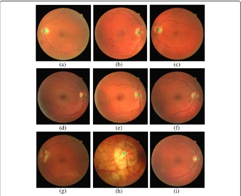 Figure 6 Optic disc center for retina images in DRIVE dataset.