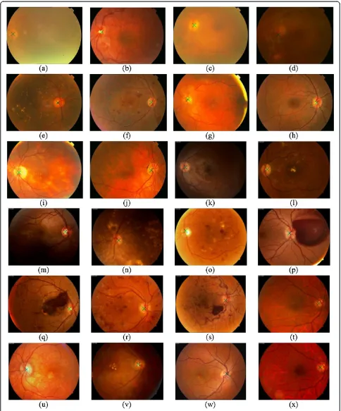 Figure 8 Optic disc center for retina images in local dataset.