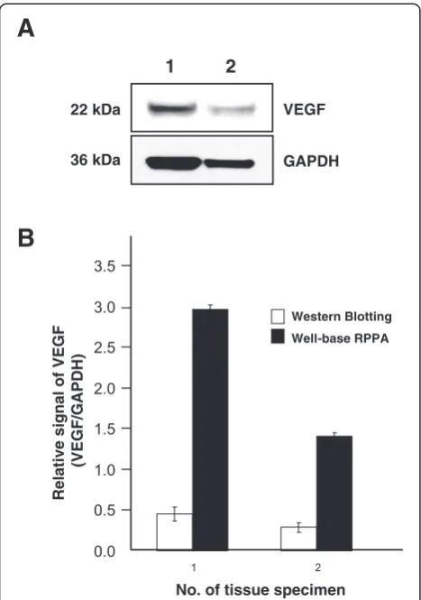 Figure 2 Immunohistochemical analysis of VEGF expression in colon tissues.expression are shown in normal colonic epithelia Representative images (final magnification, × 40) of VEGF (A), adenocarcinoma (B), mucinous adenocarcinoma (C)