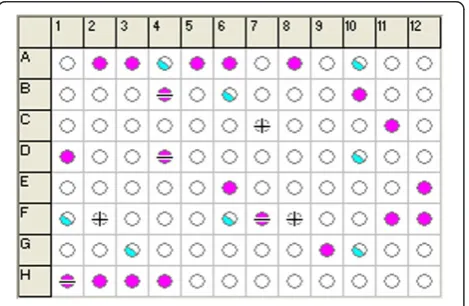 Figure 2 Substrate effect on the electricity generation ofS. loihica PV-4 in MFCs.