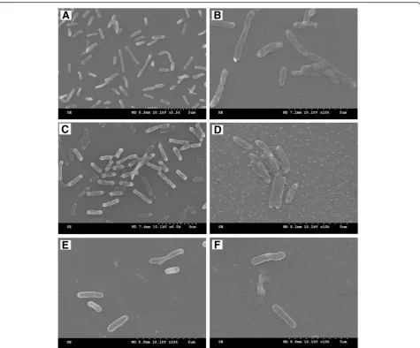 Figure 5 SEM images of S. loihica PV-4 on ITO electrode in MFCs after 25 h of electricity generation with lactic acid (A), formic acid (B),cyclodextrin (C), galactose (D), arabinose (E) and glucose (F) as substrates.