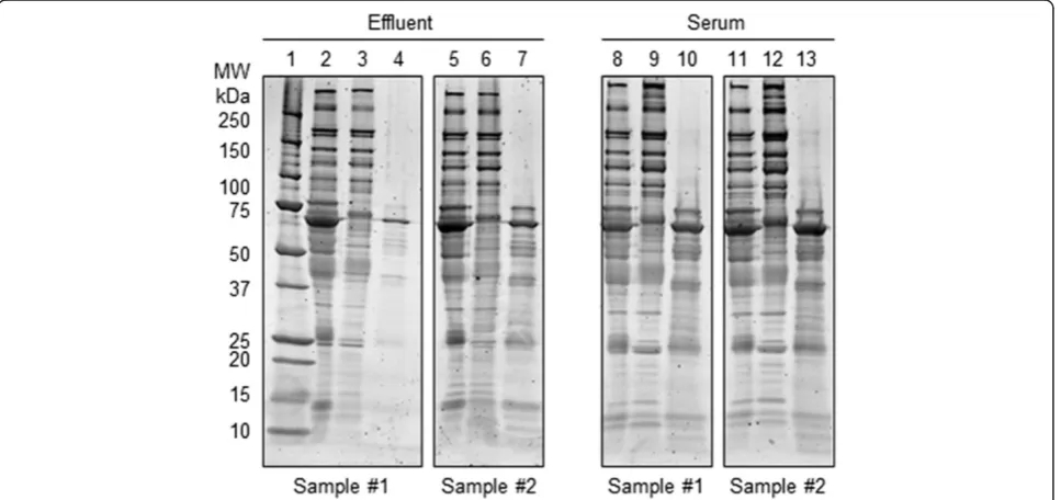 Figure 2 SDS-PAGE of effluent and serum samples after high abundant protein removal. Lane 1: Bio-Rad Precision Plus protein standard.Lanes 2 and 5: Crude effluent