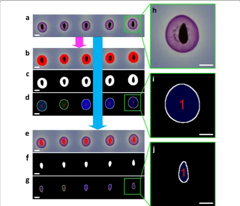Fig. 3 The work flow of the labelling and numbering pipeline. image duplicata after segmentation of the soluble mucilage halos around the seeds (purple‑pink)