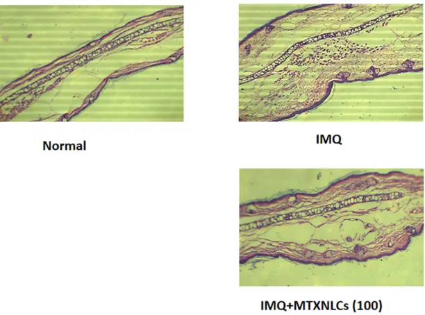 Figure 8 Effect of MTXNLCs on histopathological alterations in IMQ-induced psoriasis in mice.