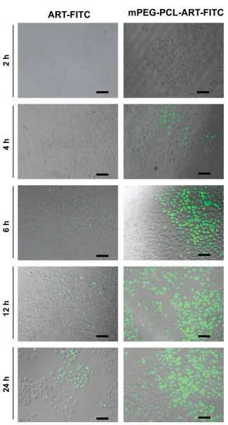 Figure 3 Representative confocal microscopy images of ART-FITC and mPEG-PCL-ART-FITC-NPs endocytosed by ﬁbroblast cells for 2, 4, 6, 12 and 24 h