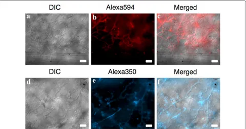 Fig. 4 fluorophore (red, Plasmopara obducens colonizing Impatiens walleriana tissues as visualized on the abaxial leaf surface using probes labeled with Alexa595 a–c) or Alexa350 fluorophore (blue, d–f) fluorophores